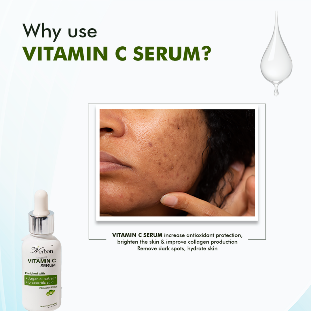 VITAMIN C SERUM (30ML)