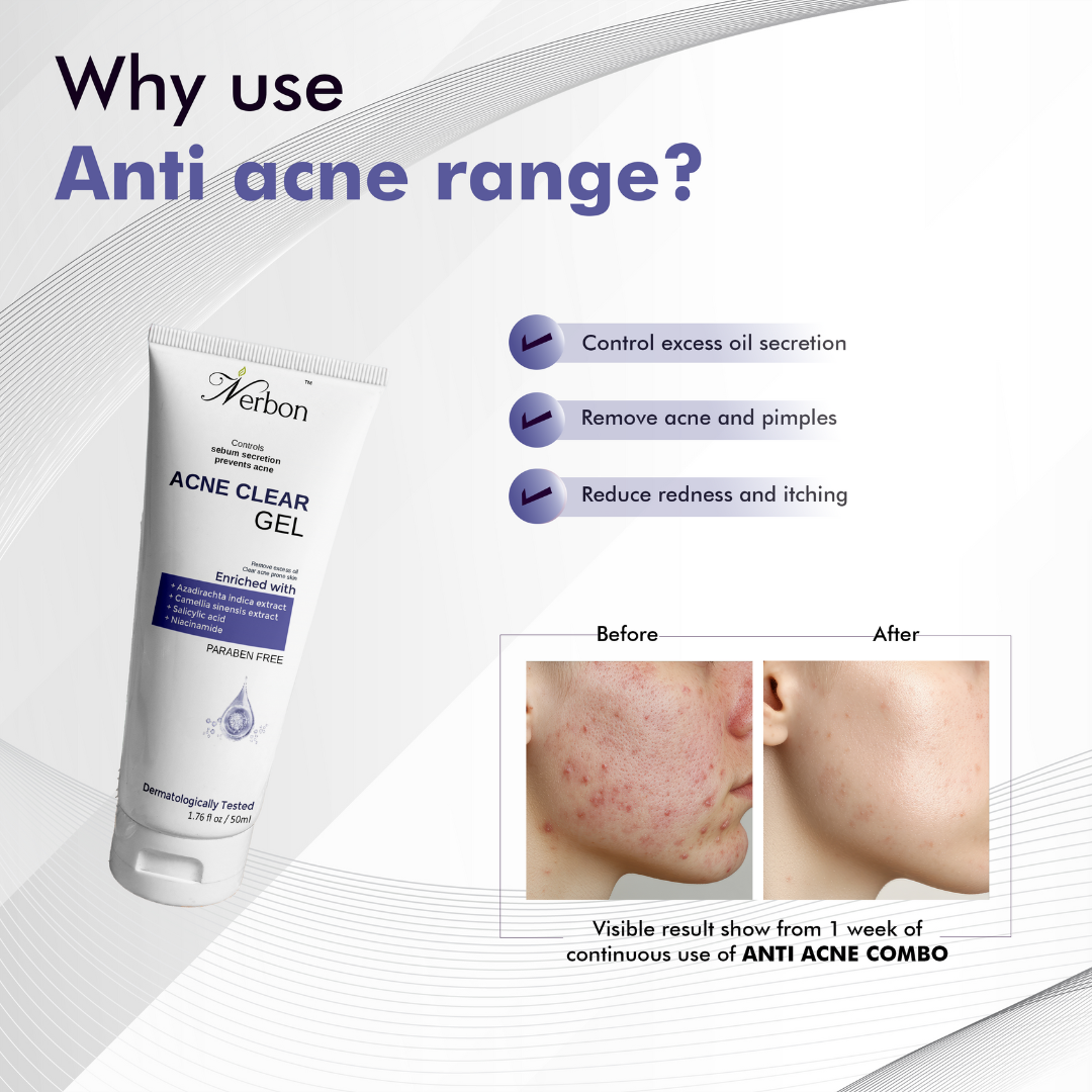 ANTI ACNE GEL