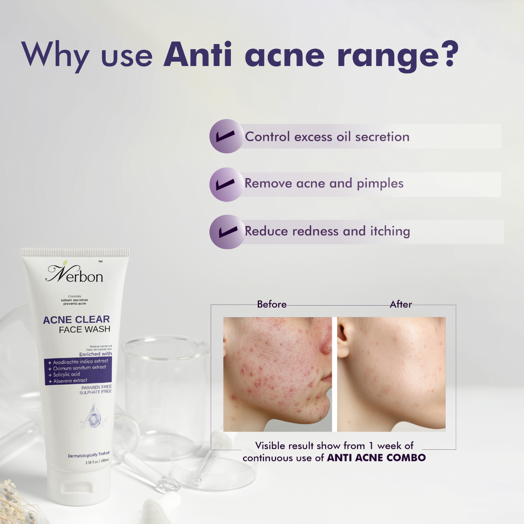 ANTI ACNE FACE WASH