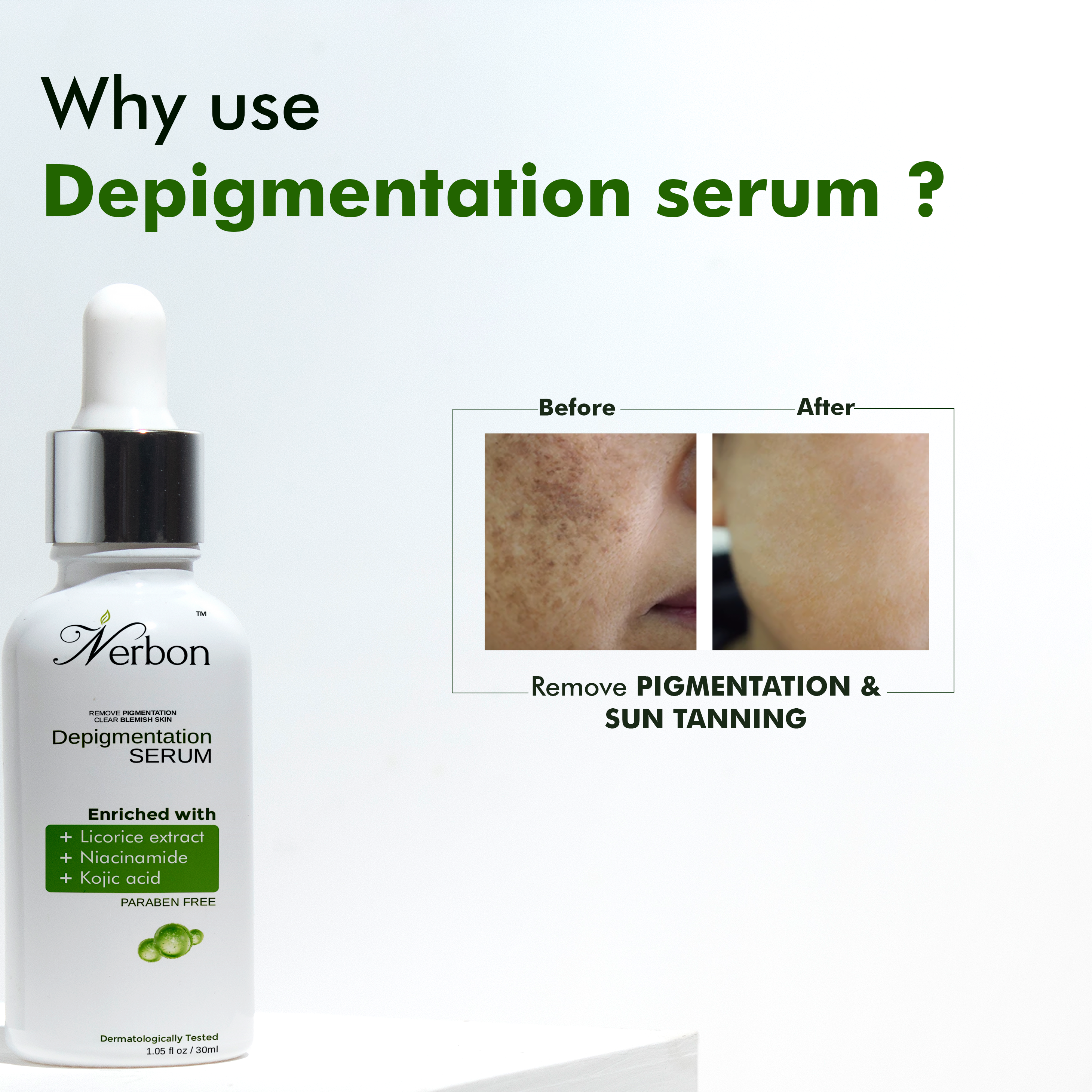 NERBON DEPIGMENTATION SERUM (30ML)